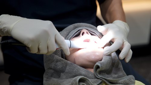 口腔内スキャナーによるデジタル検査
