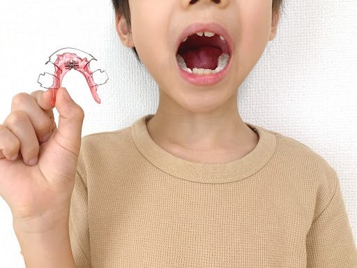お子様の歯の生え変わりのイメージ